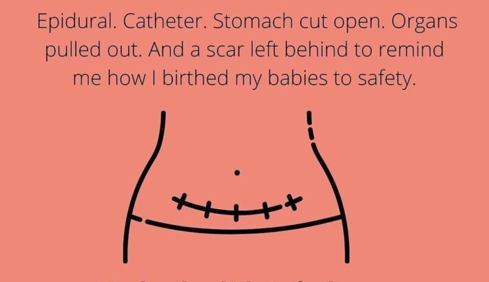 I am a C section mama
